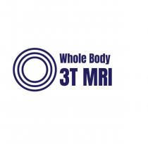 WHOLE BODY 3T MRI
