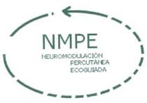 NMPE NEUROMODULACION PERCUTANEA ECOGUIADA