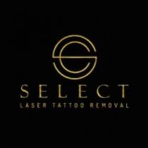 SELECT LASER TATTOO REMOVAL