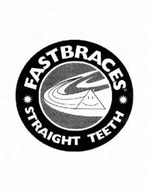 FASTBRACES STRAIGHT TEETH