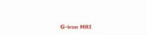 G-iron MRI. Il marchio è costituito dalla parola G-Iron con la lettera G iniziale maiuscola seguita dal segno -