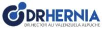 DRHERNIA DR. HECTOR ALI VALENZUELA ALPUCHE