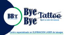 BYE BYE TATTOO