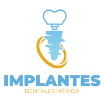 IMPLANTES DENTALES MÉRIDA