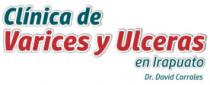 CLINICA DE VARICES Y ULCERAS EN IRAPUATO DAVID CORRALES