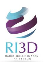 RI3D RADIOLOGIA E IMAGEN 3D