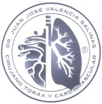 DR. JUAN JOSÉ VALENCIA SALINAS CIRUJANO TORÁX Y CARDIOVASCULAR