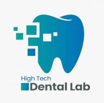HIGH TECH DENTAL LAB