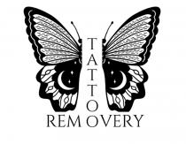 TATTOO REMOVERY