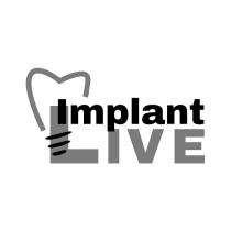 IMPLANT LIVELIVE