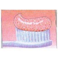 SPECKLED TOOTHPASTE (Red Gel with Red & White Speckles)