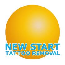 New Start Tattoo Removal