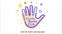 Family Burns Club Not all scars can be seen