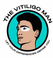 THE VITILIGO MAN - LET YOUR DIFFERENCES DEFINE YOU