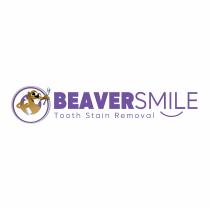 BEAVERSMILE TOOTH STAIN REMOVAL