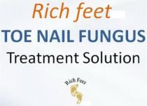 RICH FEET TOENAIL FUNGUS TREATMENT SOLUTION RICH FEET