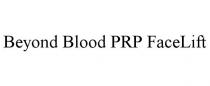 BEYOND BLOOD PRP FACELIFT