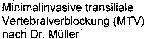 Minimalinvasive transiliale Vertebralverblockung (MTV) nach Dr. Müller