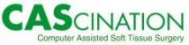 CASCINATION Computer Assisted Soft Tissue Surgery