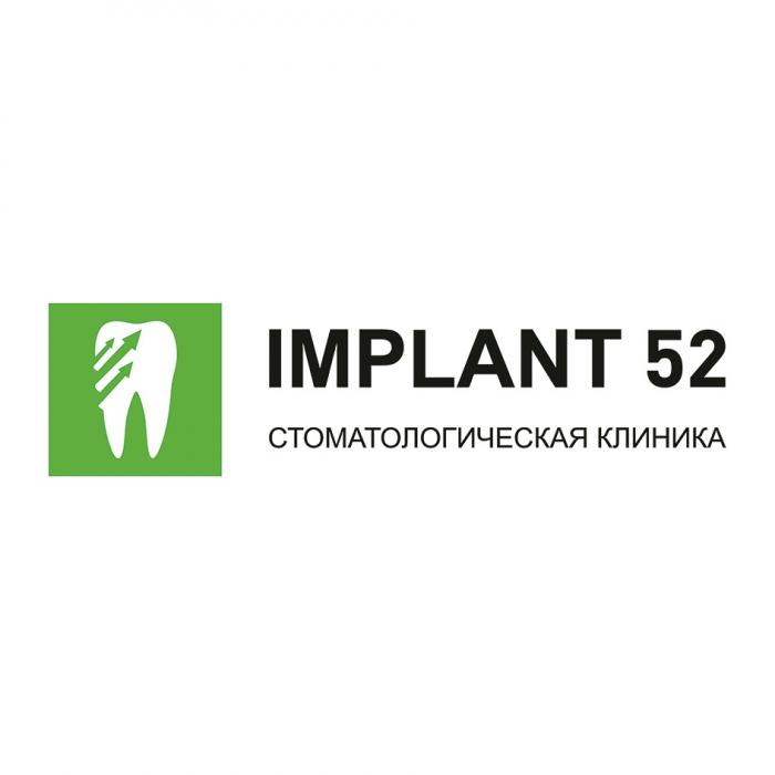 IMPLANT 52 СТОМАТОЛОГИЧЕСКАЯ КЛИНИКАКЛИНИКА